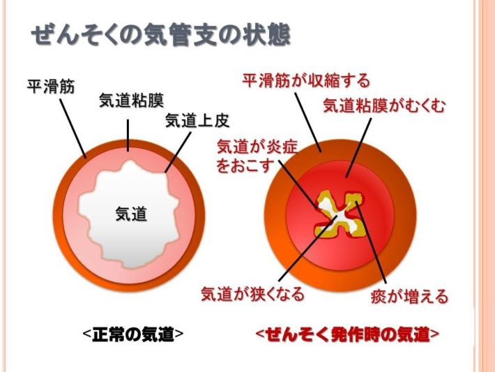 考えられる原因